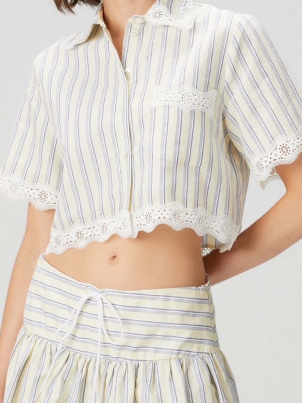 Striped Cropped Button-Up Top with Lace Trim - White & Yellow